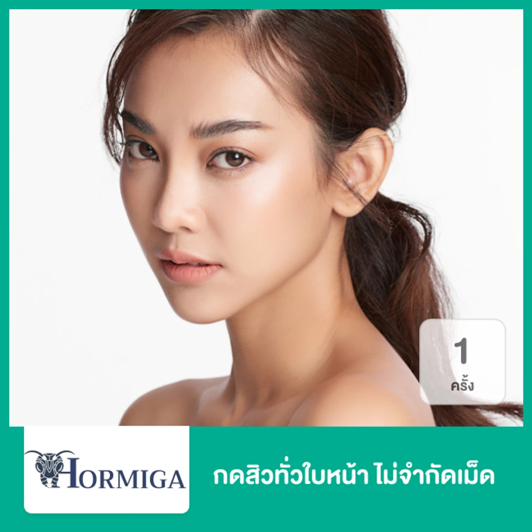 กดสิวทั่วใบหน้า ไม่จำกัดเม็ด 1 ครั้ง