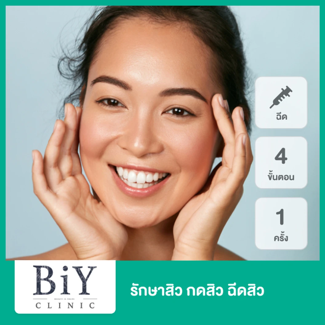 รักษาสิว กดสิว ฉีดสิว 4 ขั้นตอน 1 ครั้ง