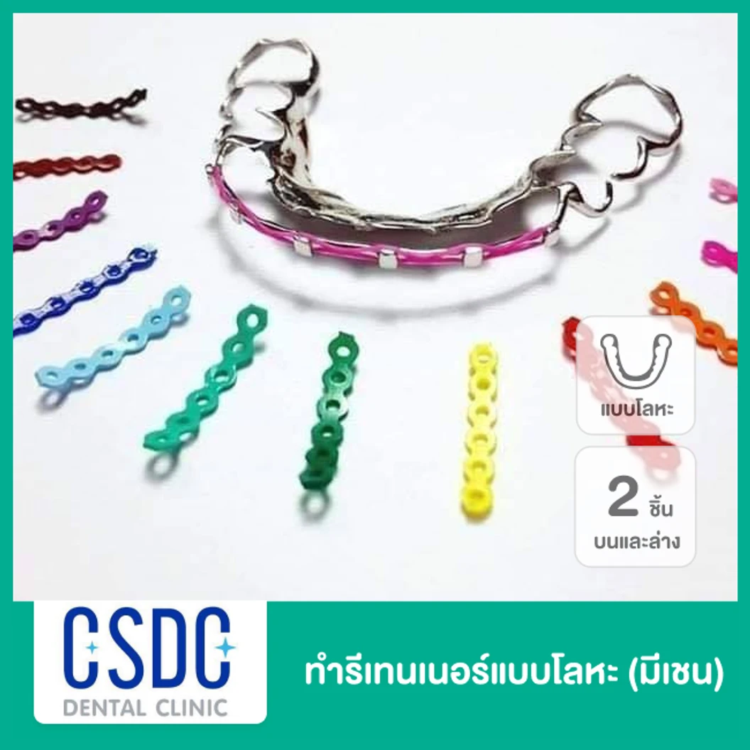 ทำรีเทนเนอร์แบบโลหะ (มีเชน) 2 ชิ้น ฟันบนและล่าง