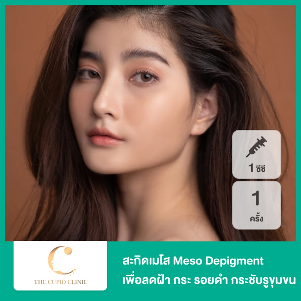 สะกิดเมโส Meso Depigment 1 ซีซี ทั่วใบหน้า เพื่อลดฝ้า กระ รอยดำ กระชับรูขุมขน 1 ครั้ง