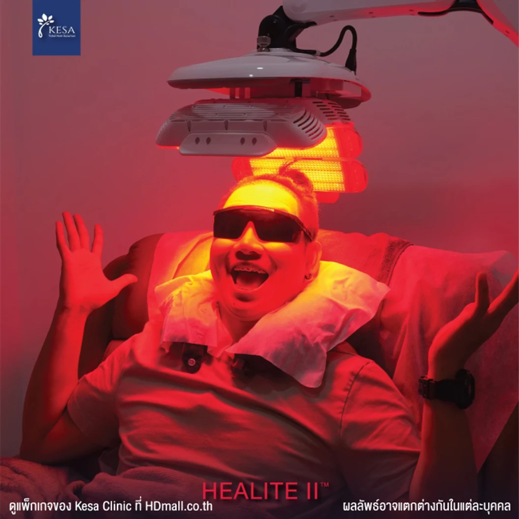 กระตุ้นรากผม กระตุ้นผมเกิดใหม่ ลดการขาดหลุดร่วง ด้วยเลเซอร์ HEALITE II เทคโนโลยี Low Level Laser Light Therapy (LLLT) 1 ครั้ง