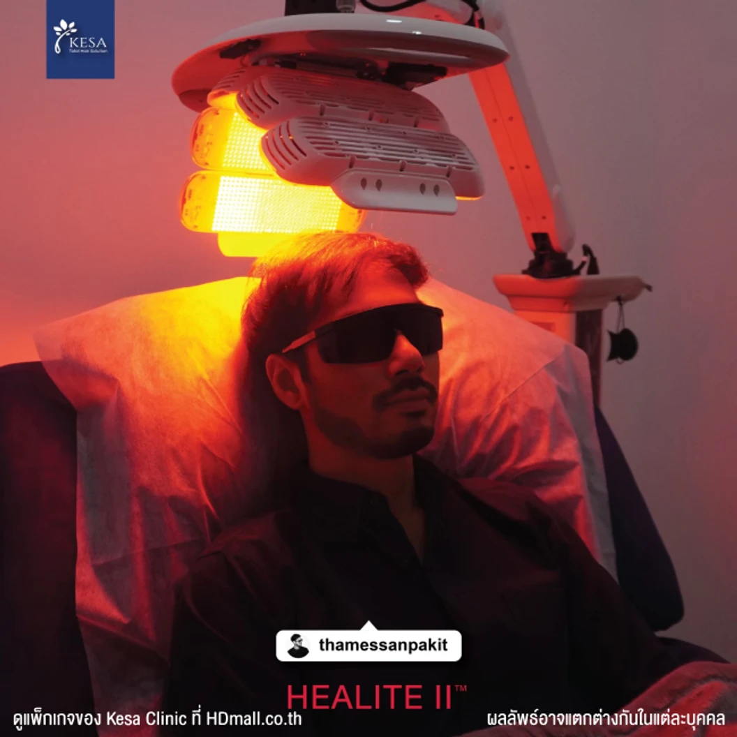 กระตุ้นรากผม กระตุ้นผมเกิดใหม่ ลดการขาดหลุดร่วง ด้วยเลเซอร์ HEALITE II เทคโนโลยี Low Level Laser Light Therapy (LLLT) 1 ครั้ง