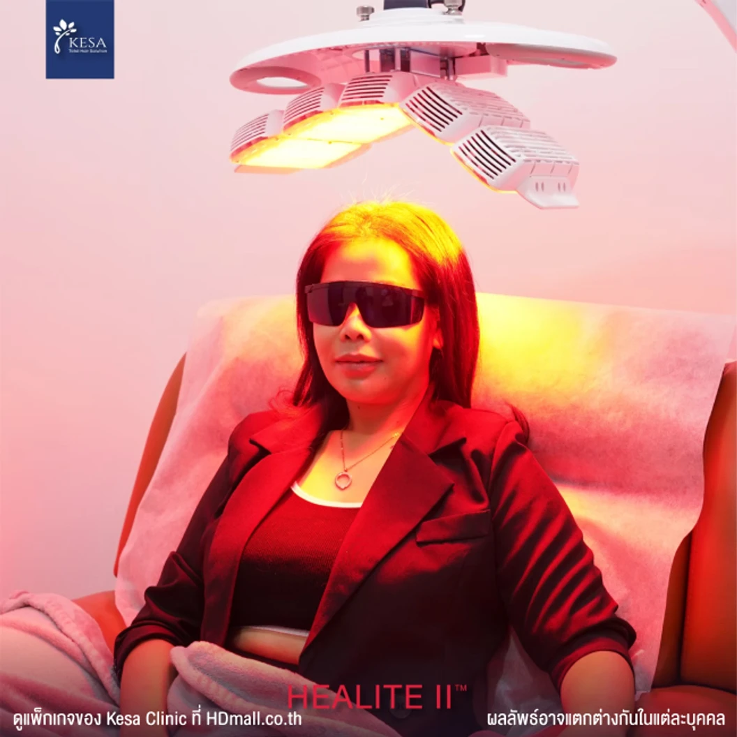 คอร์สกระตุ้นรากผม กระตุ้นผมเกิดใหม่ ลดการขาดหลุดร่วง ด้วยเลเซอร์ HEALITE II เทคโนโลยี Low Level Laser Light Therapy (LLLT) 6 ครั้ง