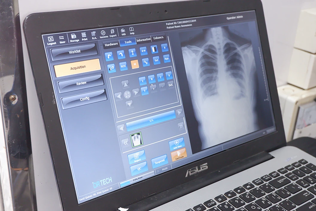ตรวจหาเชื้อ COVID-19 เทคนิค Real Time - PCR แบบตรวจที่คลินิก + ใบรับรองแพทย์ สำหรับ 1 ท่าน