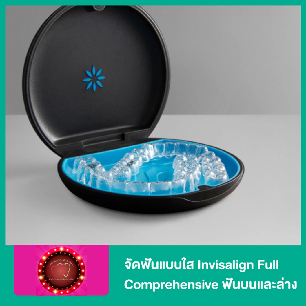 จัดฟันแบบใส Invisalign Full Comprehensive ฟันบนและล่าง