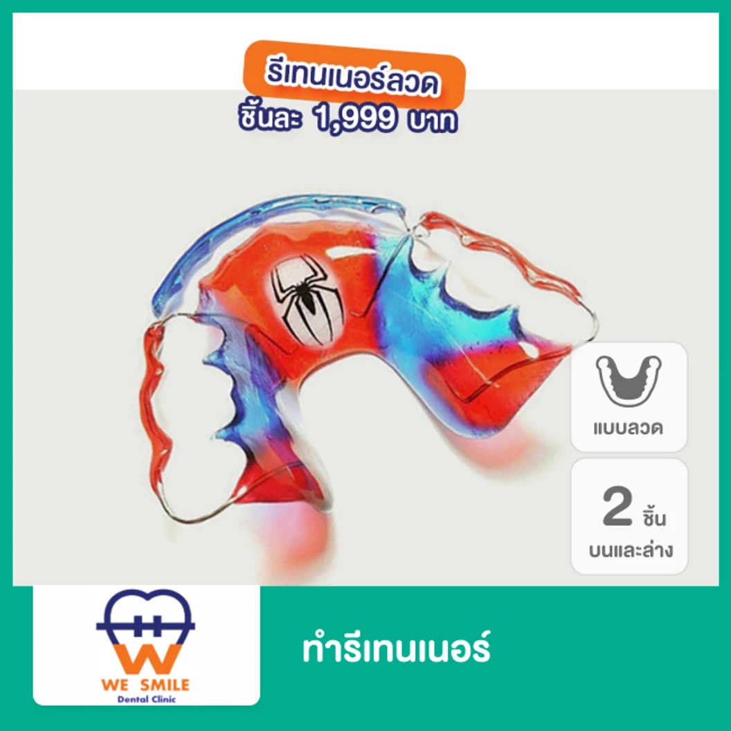 ทำรีเทนเนอร์แบบลวด 2 ชิ้น ฟันบนและล่าง