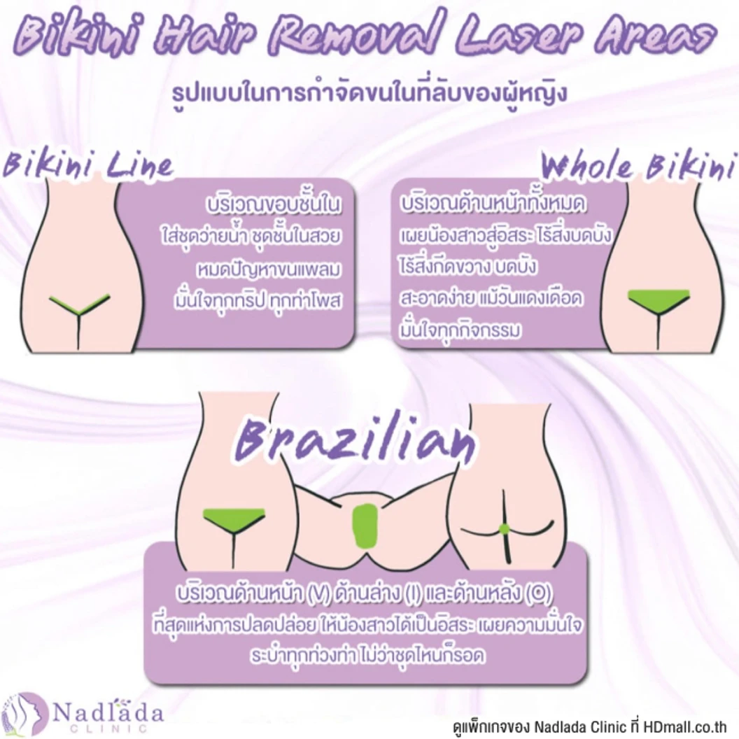 คอร์สกำจัดขน Whole Bikini ด้วย YAG Laser 3 ครั้ง สำหรับผู้หญิงเท่านั้น