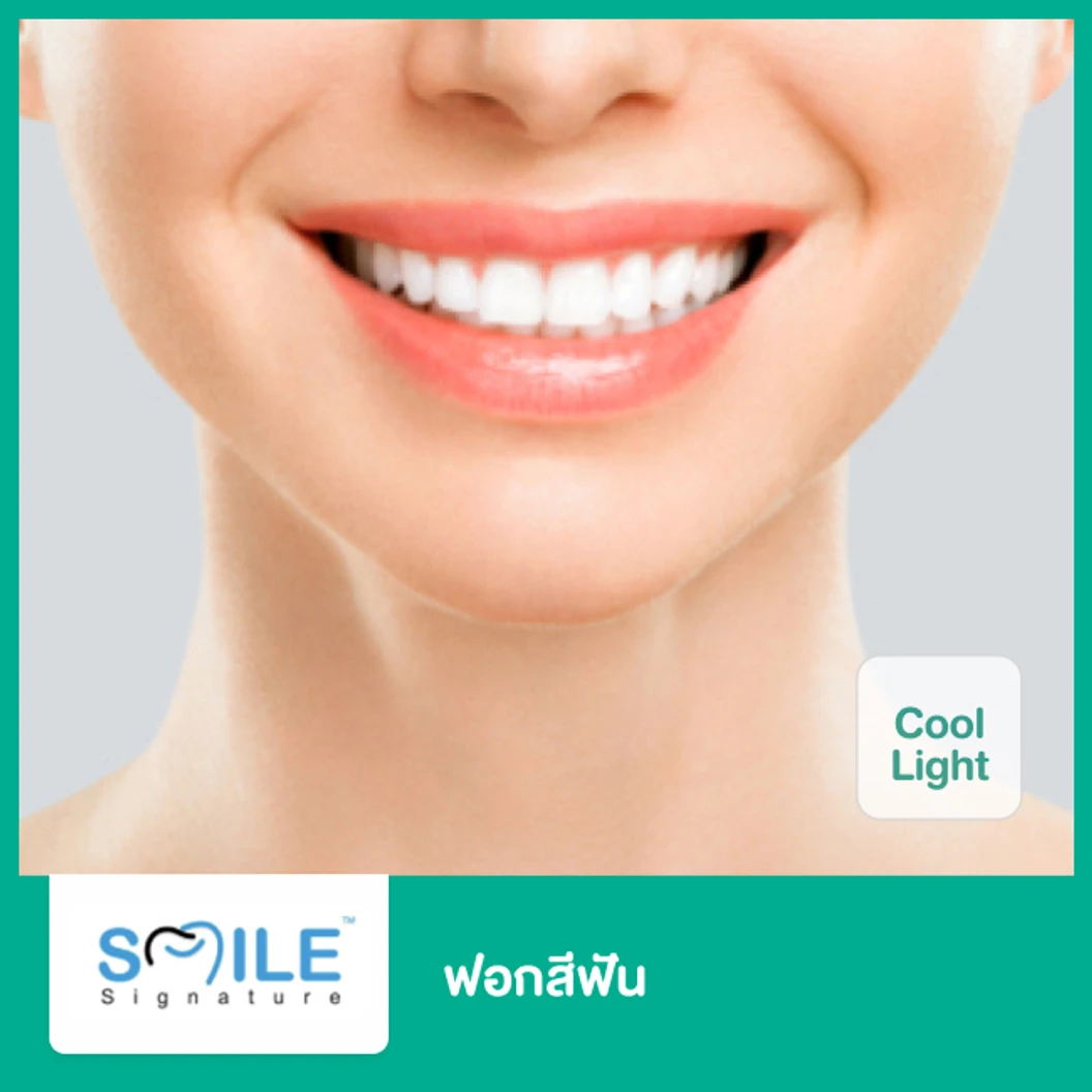 ฟอกสีฟันที่คลินิก ด้วยระบบ Cool Light ฟรี! ขูดหินปูน