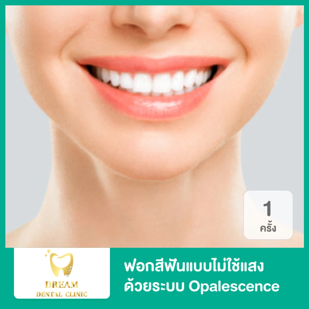 ฟอกสีฟันแบบไม่ใช้แสง ด้วยระบบ Opalescence 1 ครั้ง