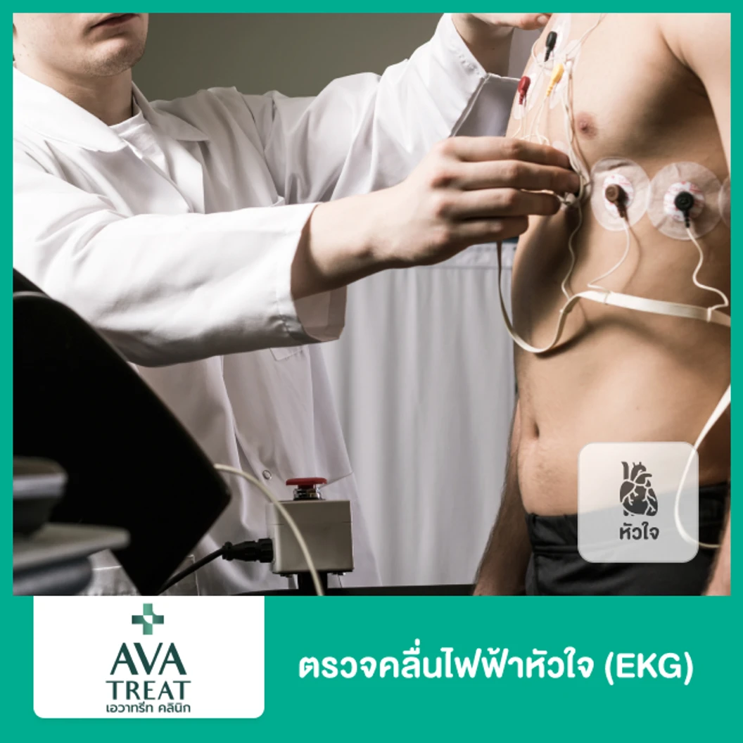 ตรวจคลื่นไฟฟ้าหัวใจ (EKG)