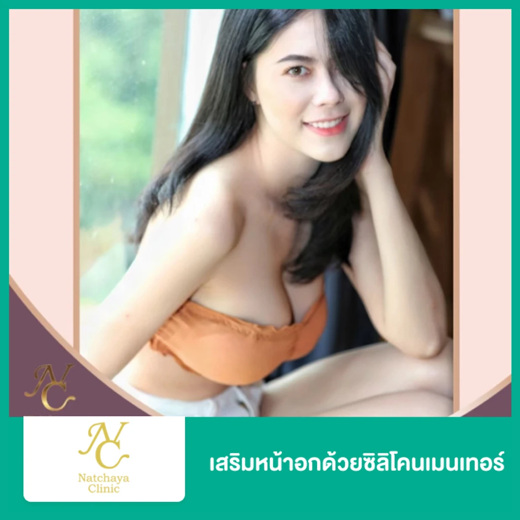 เสริมหน้าอก เทคนิควางซิลิโคนใต้กล้ามเนื้อ ด้วยซิลิโคน Mentor อเมริกา เพิ่มความมั่นใจในขนาดหน้าอก