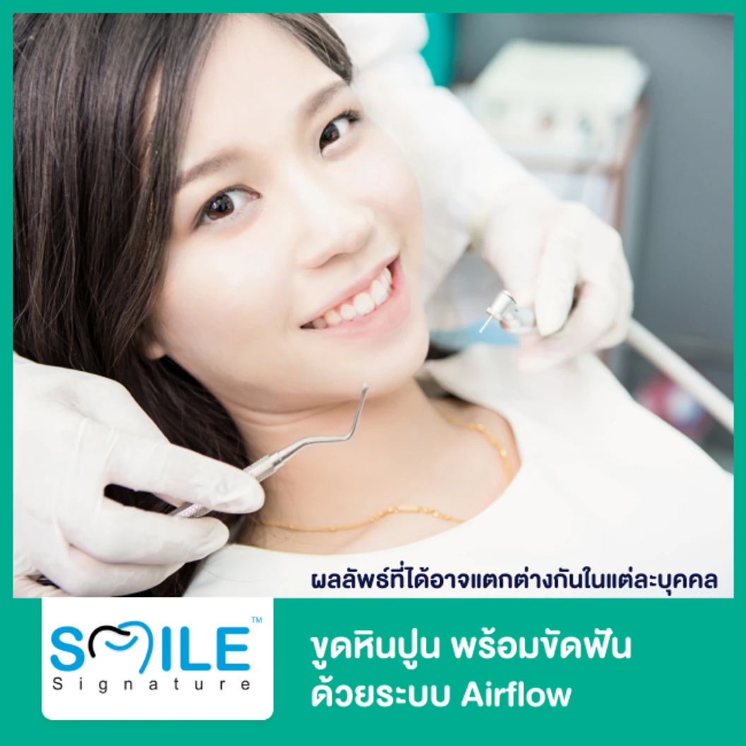 ขูดหินปูน พร้อมขัดฟันด้วยระบบ Airflow