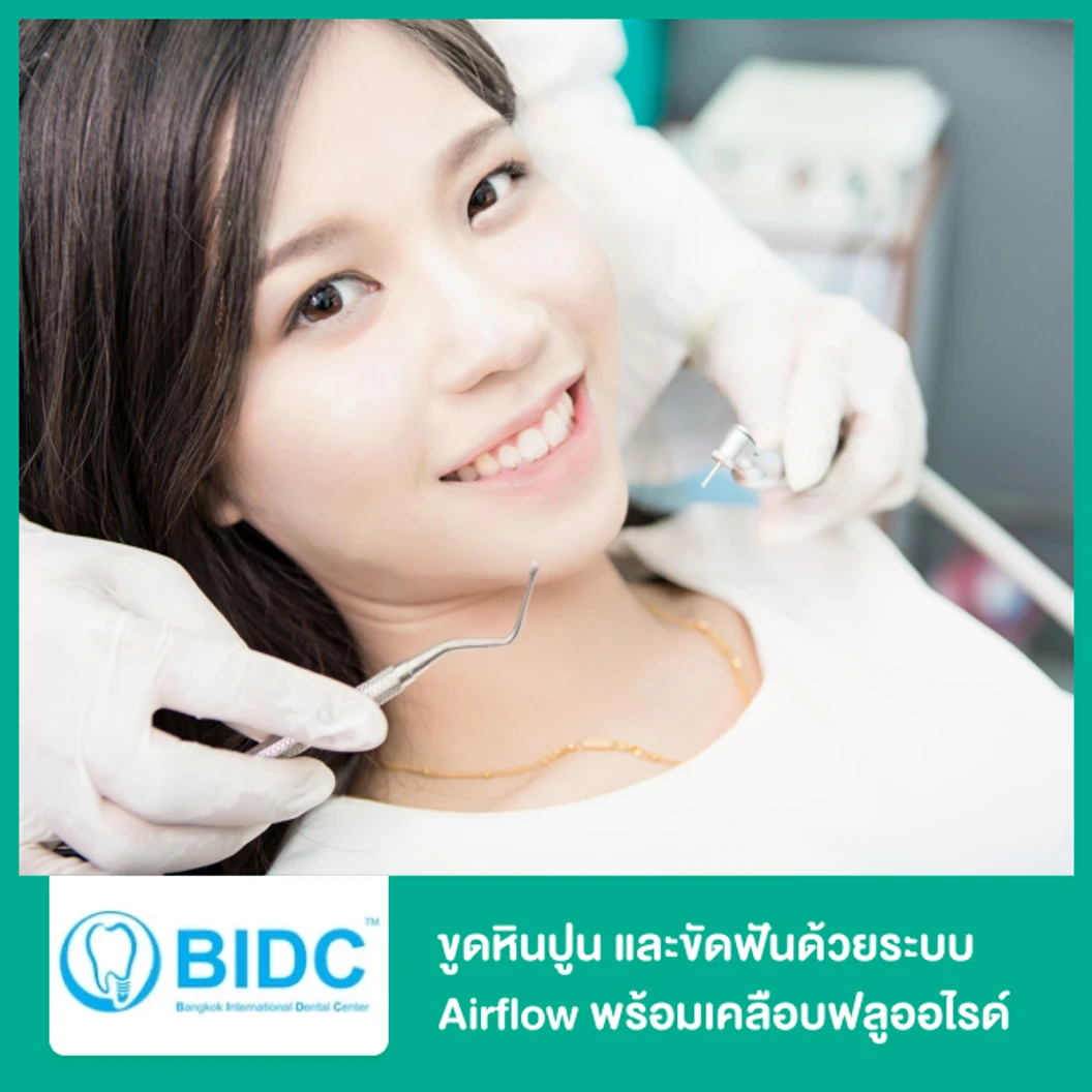 ขูดหินปูน และขัดฟันด้วยระบบ Airflow พร้อมเคลือบฟลูออไรด์