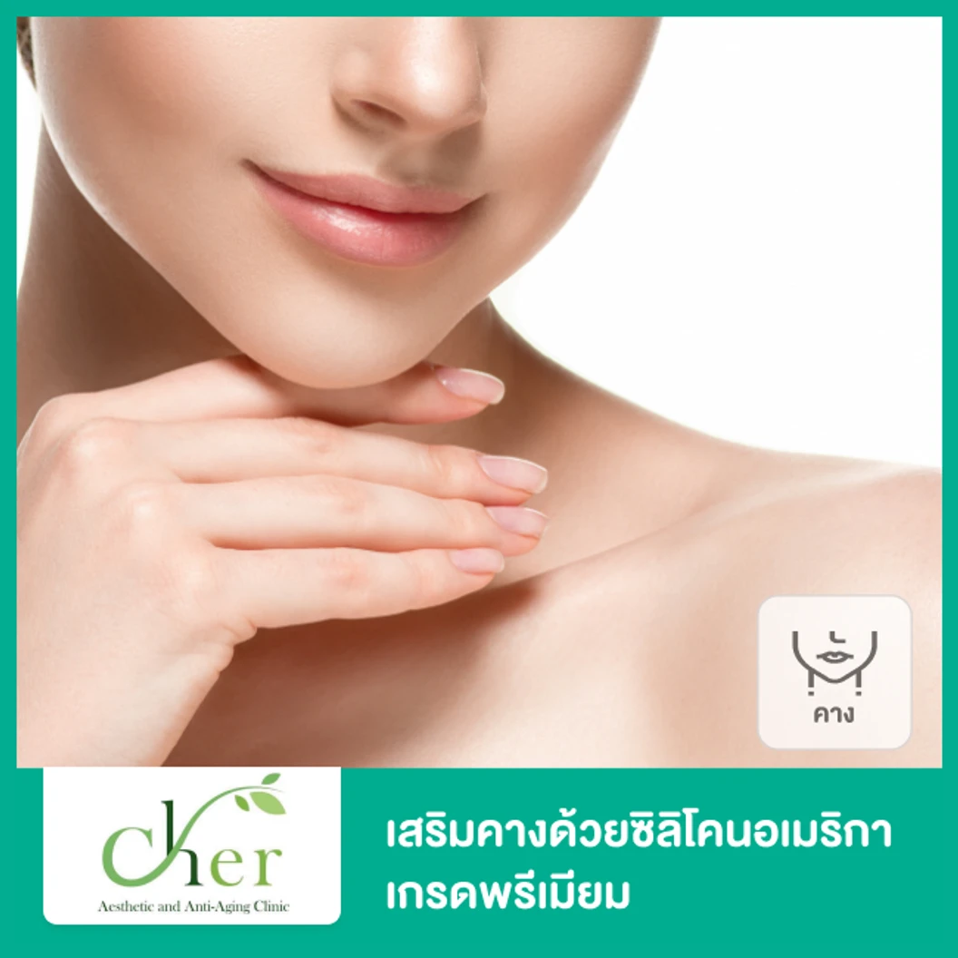 เสริมคาง ด้วยซิลิโคนอเมริกาเกรดพรีเมียม สำหรับเคสทำครั้งแรก