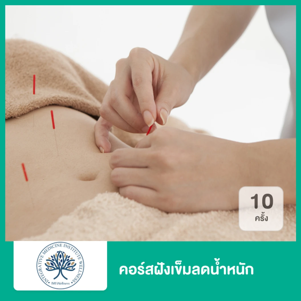 คอร์สฝังเข็มลดน้ำหนัก 10 ครั้ง