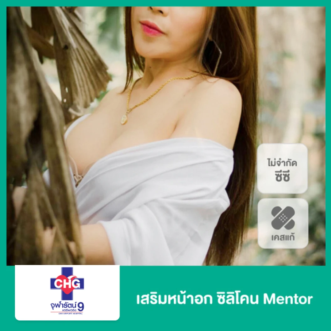 เสริมหน้าอก ซิลิโคน Mentor ไม่จำกัดซีซี ขึ้นอยู่กับแพทย์ประเมิน สำหรับผู้ที่เคยเสริมมาก่อน