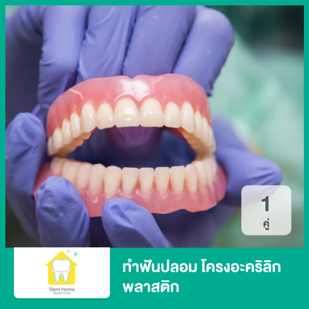 ทำฟันปลอม โครงอะคริลิก พลาสติก 1 คู่ ฟันบนและล่าง