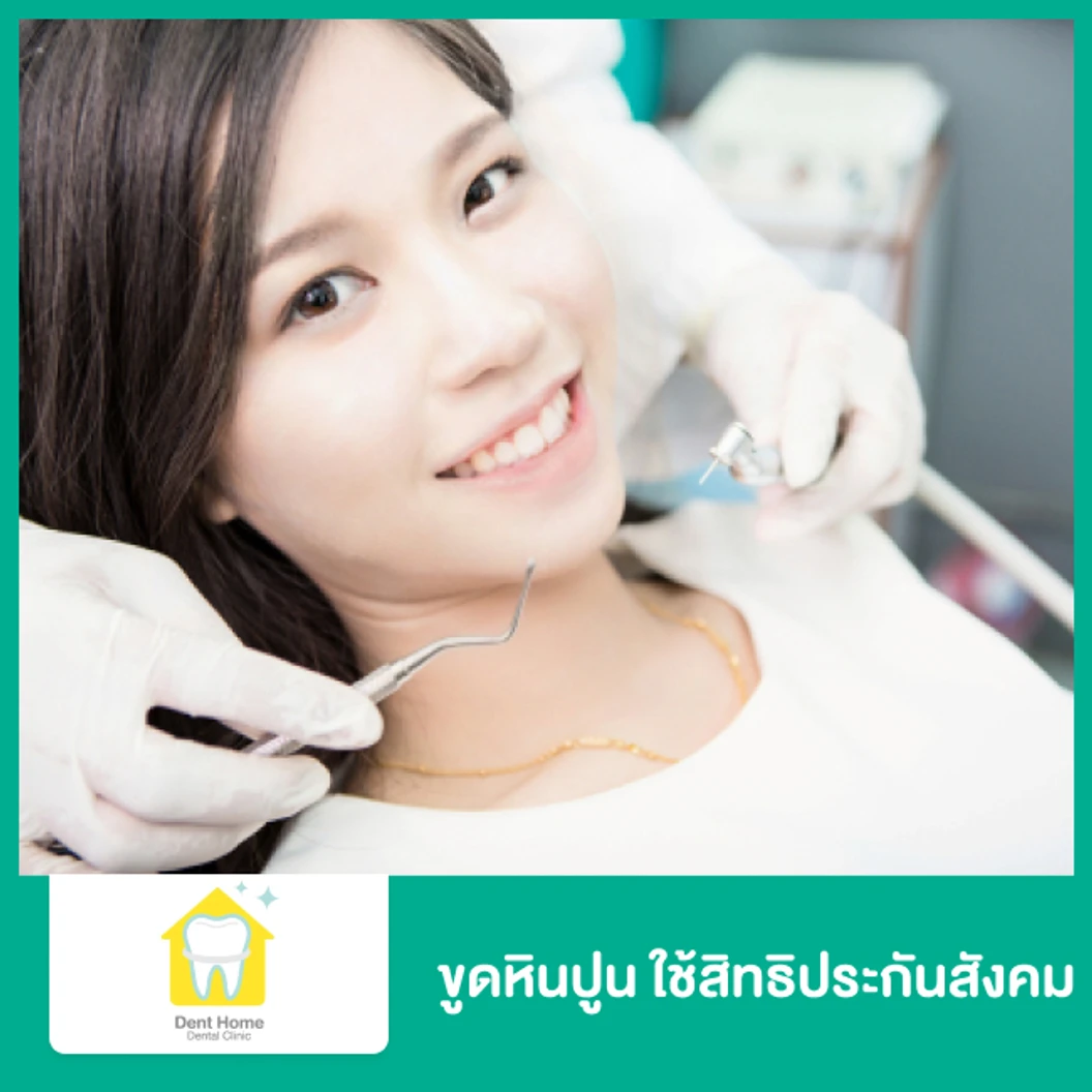 ขูดหินปูน ใช้สิทธิประกันสังคม