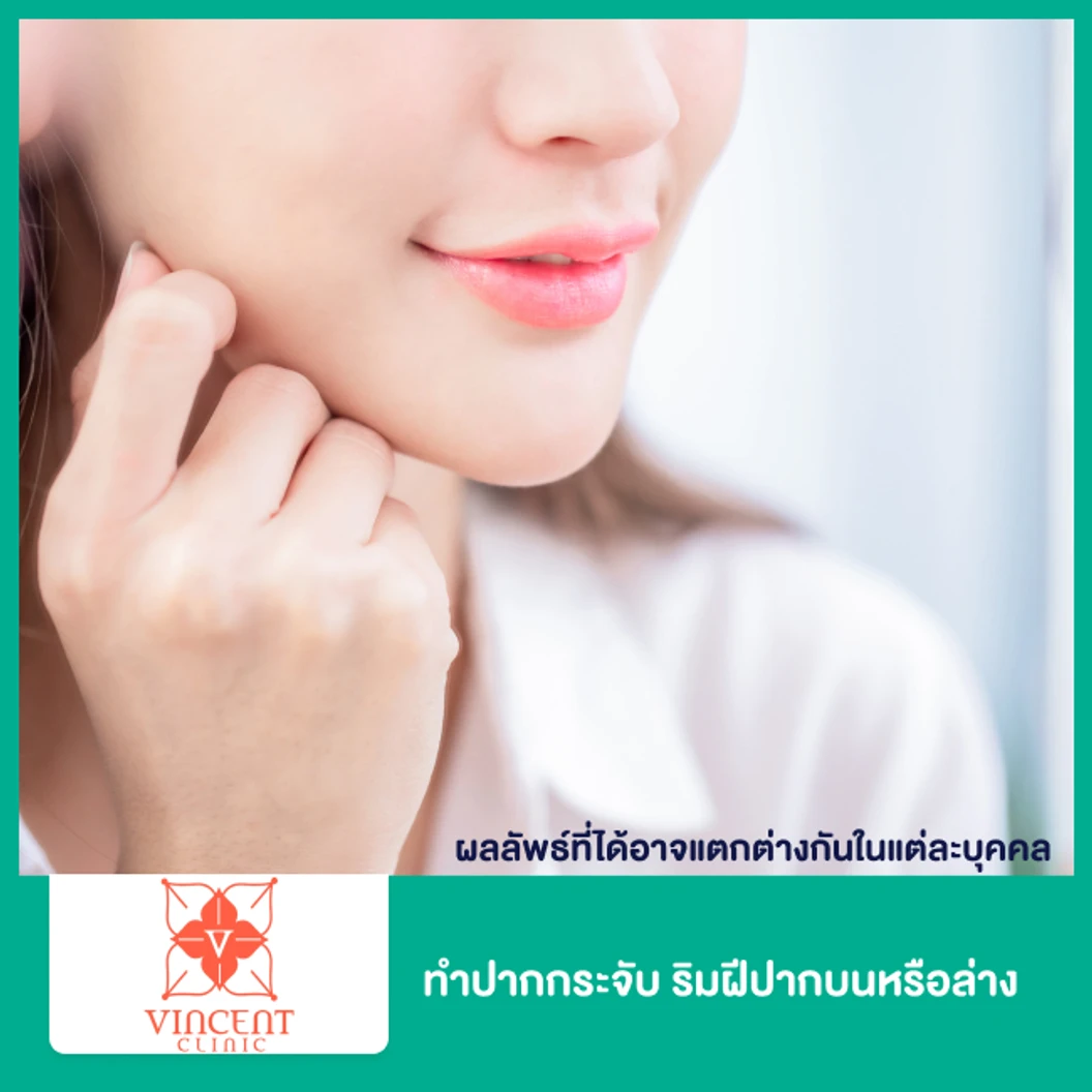 ทำปากกระจับ ริมฝีปากบนหรือล่าง (ครั้งแรก)