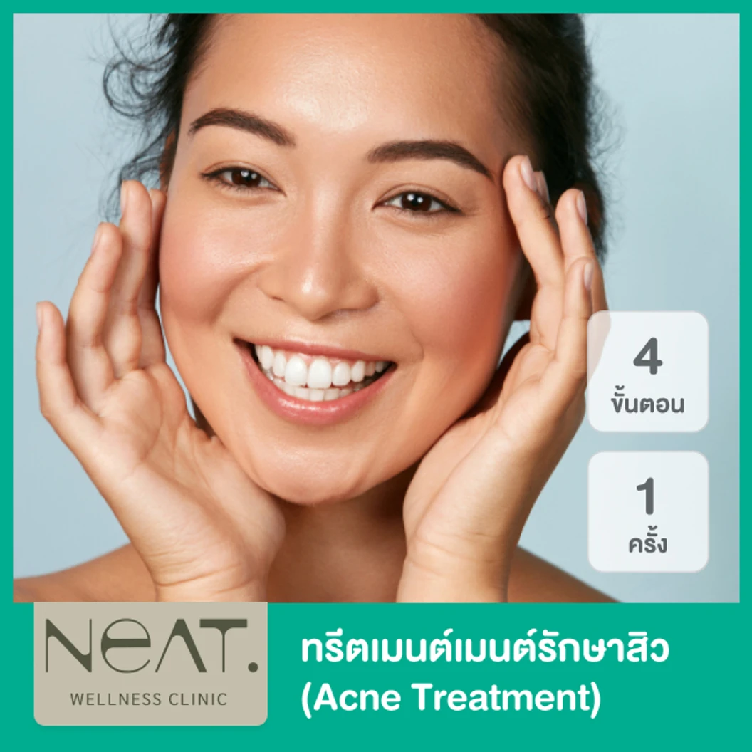 ทรีตเมนต์รักษาสิว (Acne Plus Treatment) 4 ขั้นตอน ประกอบไปด้วย กดสิว ฉีดสิว มาส์กสิว และฉายแสงฆ่าเชื้อสิว 1 ครั้ง