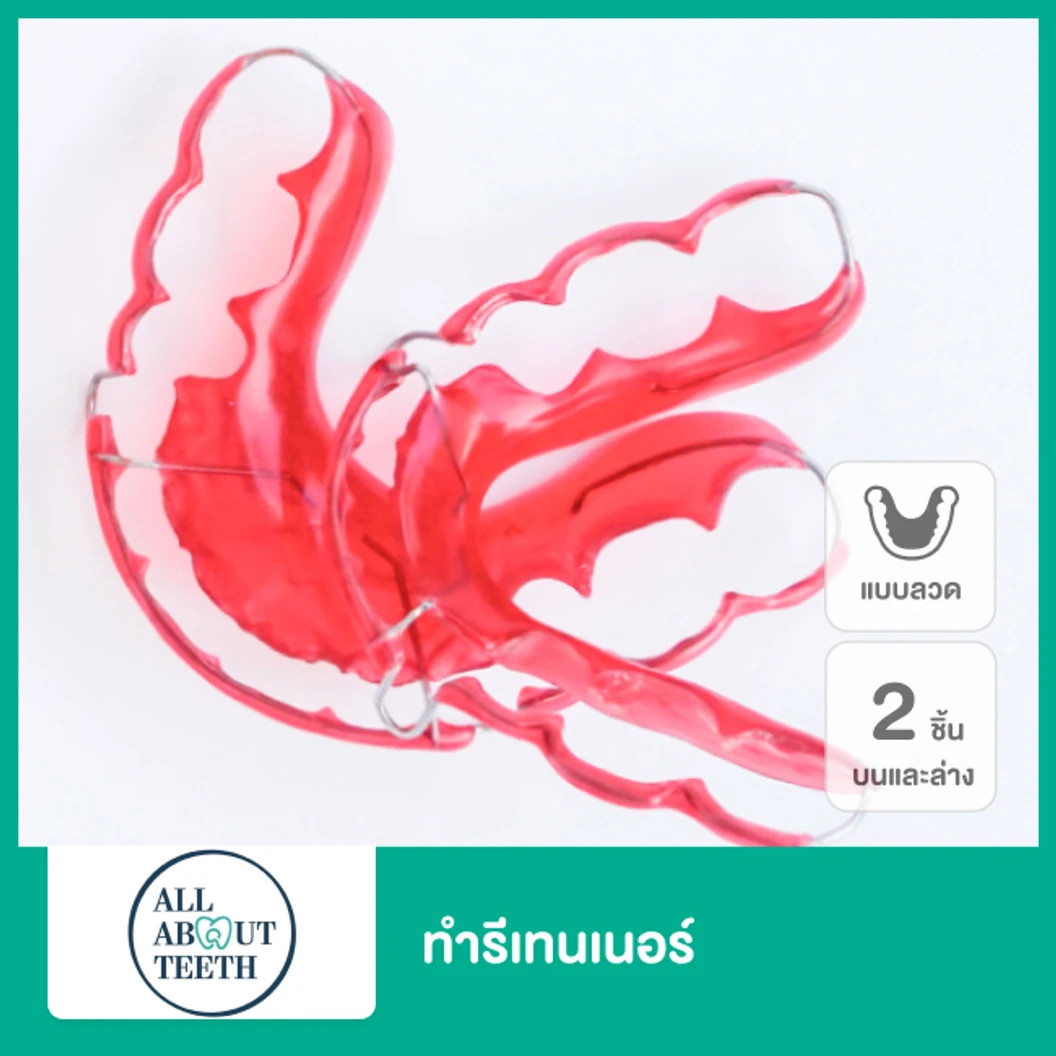 ทำรีเทนเนอร์แบบลวด 2 ชิ้น ฟันบนและล่าง