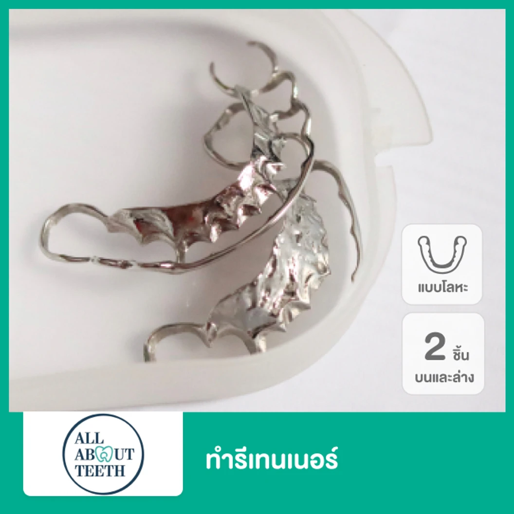 ทำรีเทนเนอร์แบบโลหะ 2 ชิ้น ฟันบนและล่าง