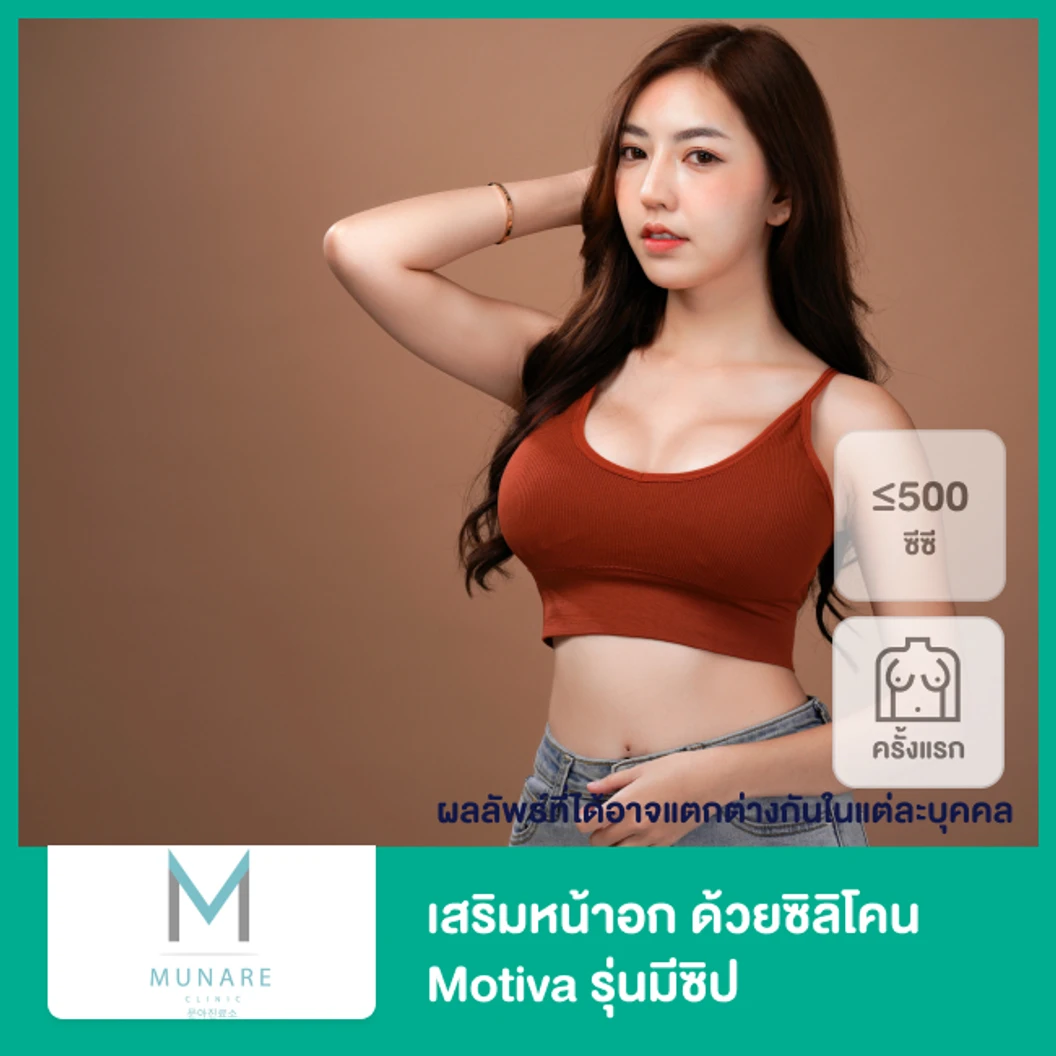 เสริมหน้าอก ด้วยซิลิโคน Motiva รุ่นมีซิป ขนาดไม่เกิน 500 ซีซี สำหรับเคสเสริมครั้งแรก