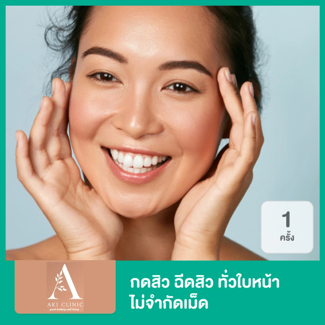 กดสิว ฉีดสิว ทั่วใบหน้า ไม่จำกัดเม็ด 1 ครั้ง