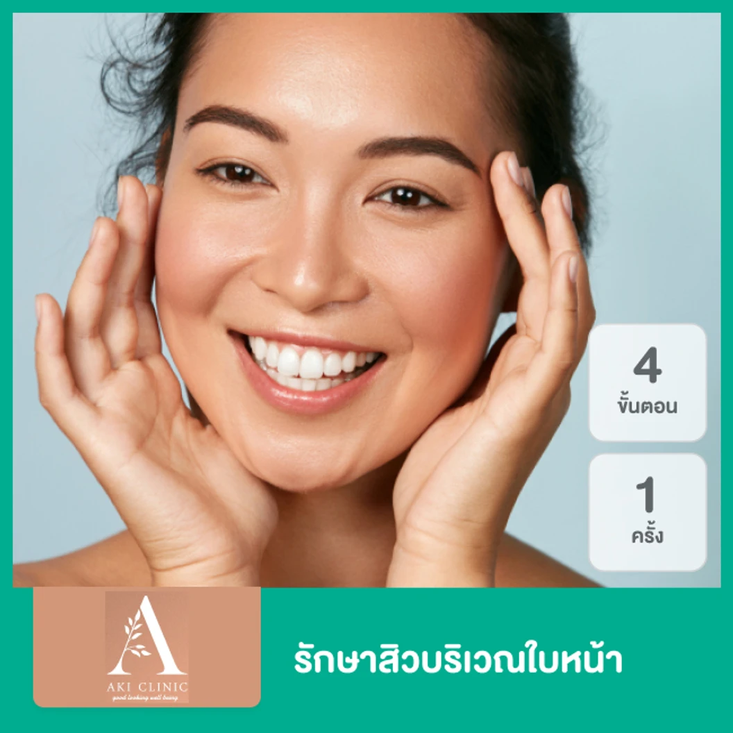 รักษาสิวบริเวณใบหน้า 4 ขั้นตอน 1 ครั้ง