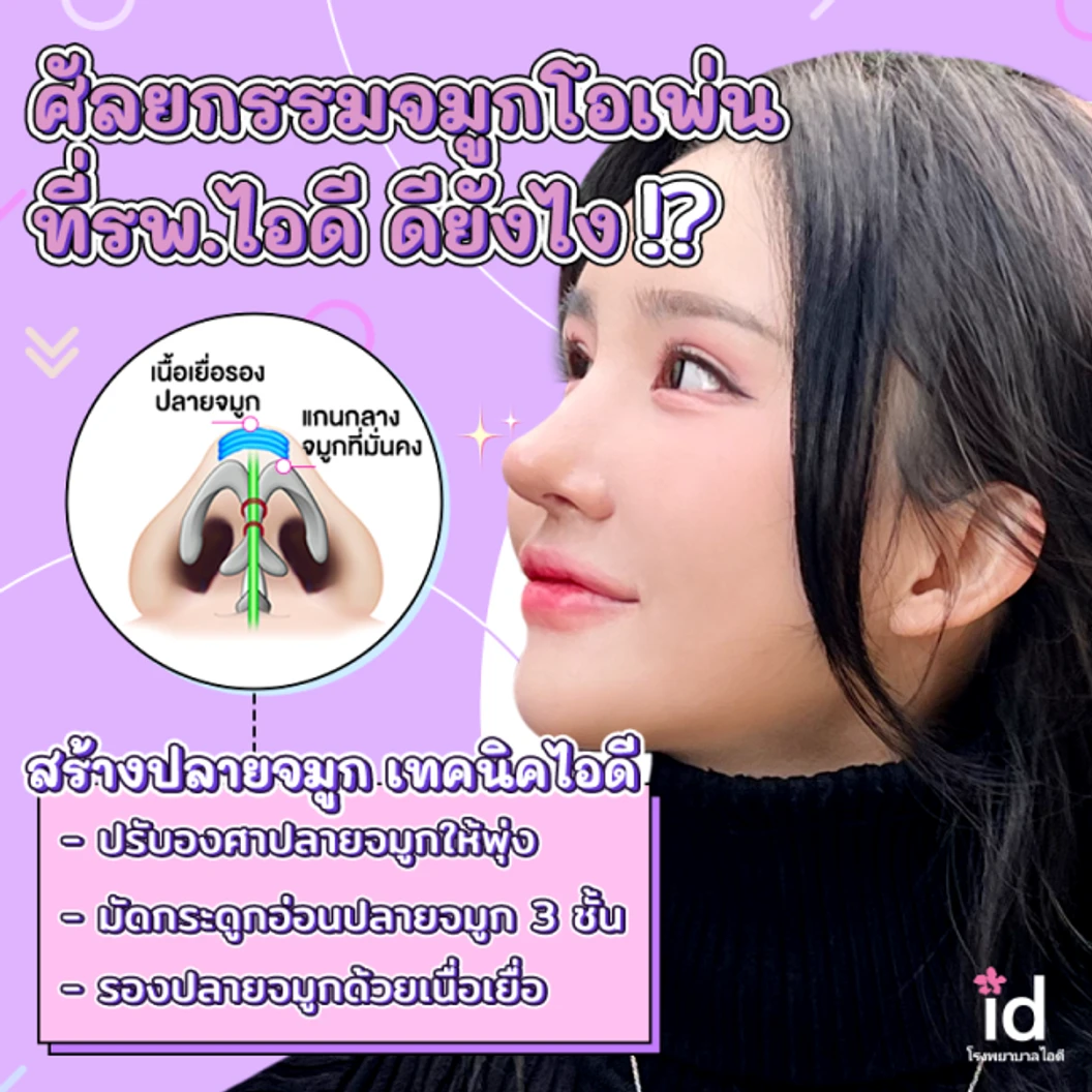 มัดจำเสริมจมูกแบบโอเพ่น 3 Steps สำหรับเคสทำครั้งแรก