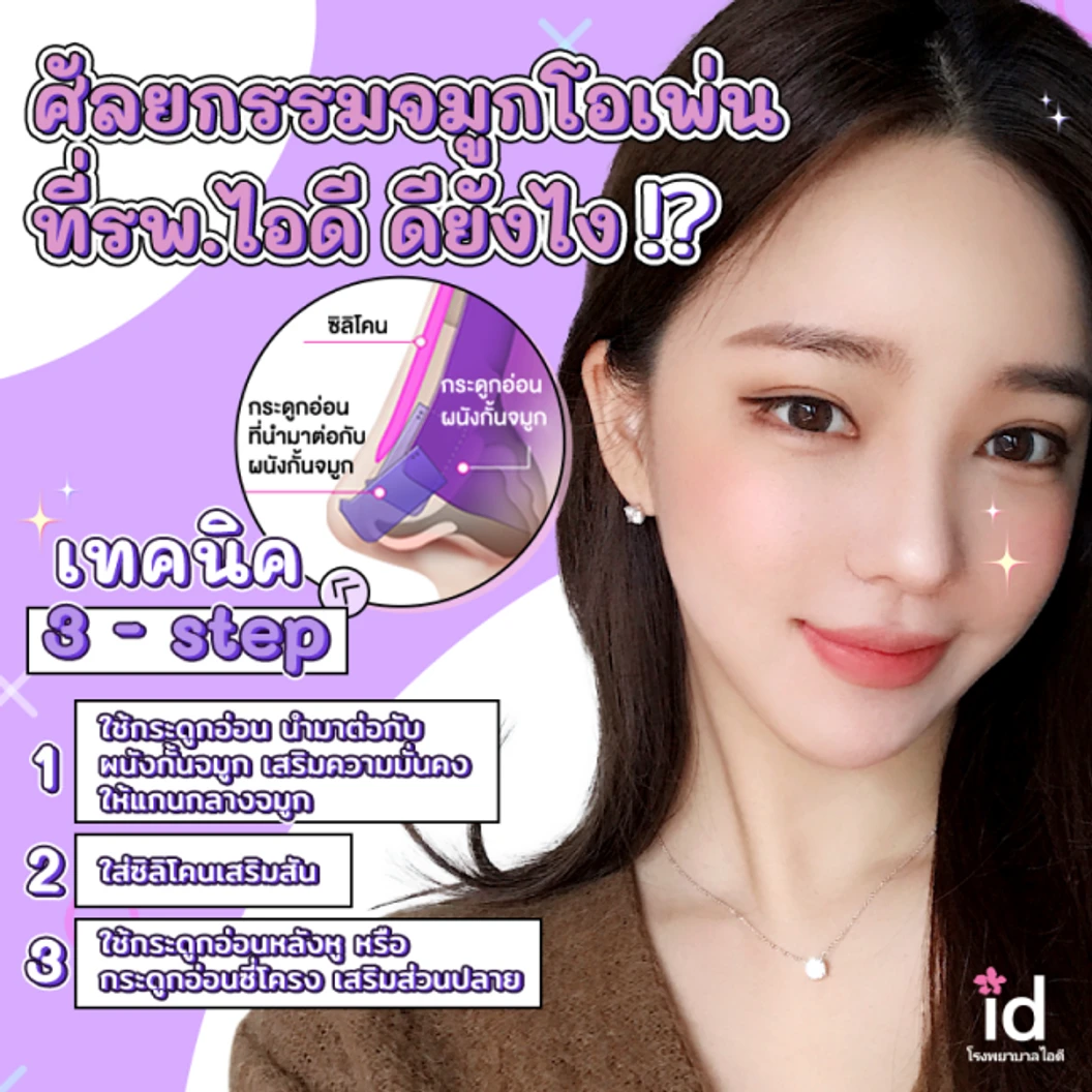 มัดจำเสริมจมูกแบบโอเพ่น 3 Steps สำหรับเคสทำครั้งแรก