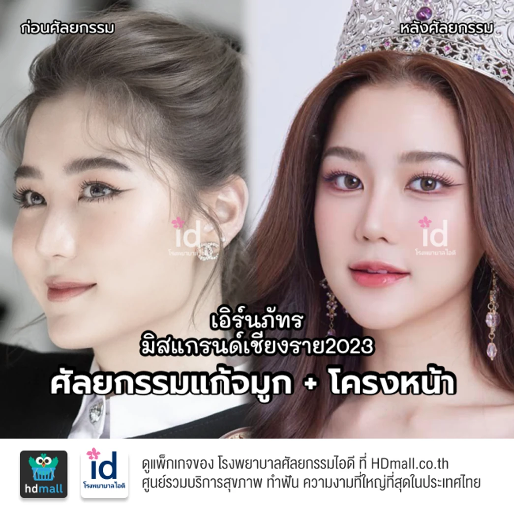 มัดจำเสริมจมูกแบบโอเพ่น 3 Steps สำหรับเคสแก้