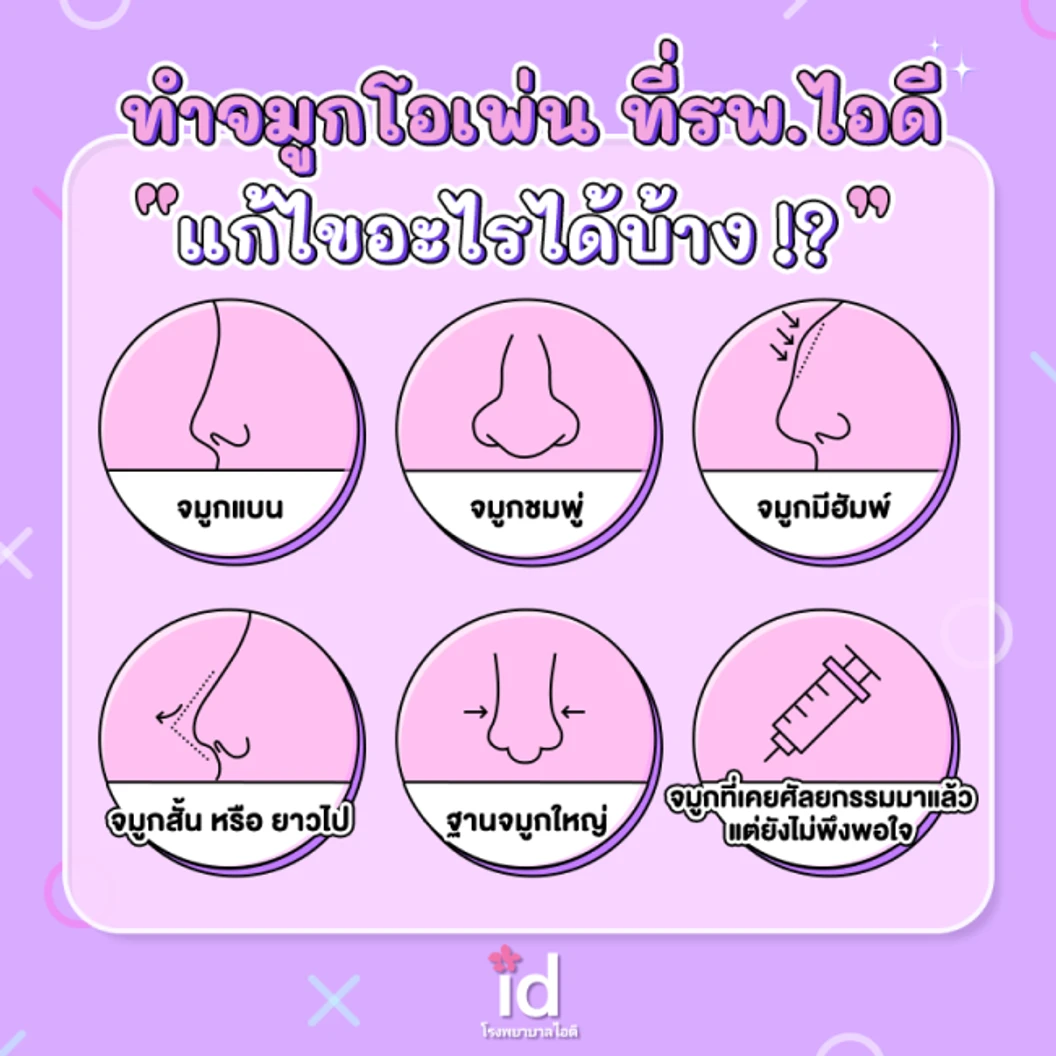 มัดจำเสริมจมูกแบบโอเพ่น 3 Steps สำหรับเคสแก้