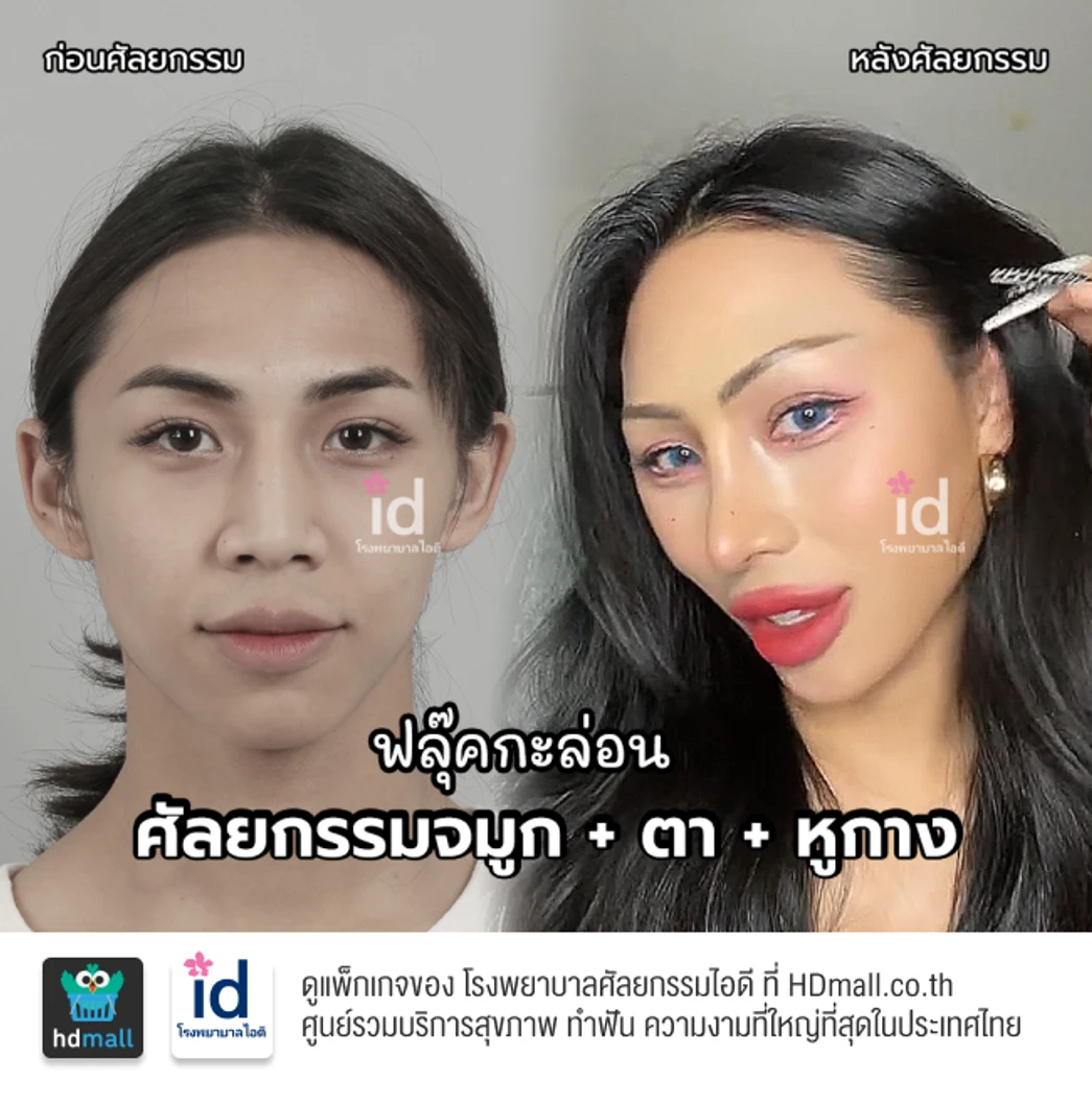 มัดจำเสริมจมูกแบบโอเพ่น 3 Steps สำหรับเคสแก้