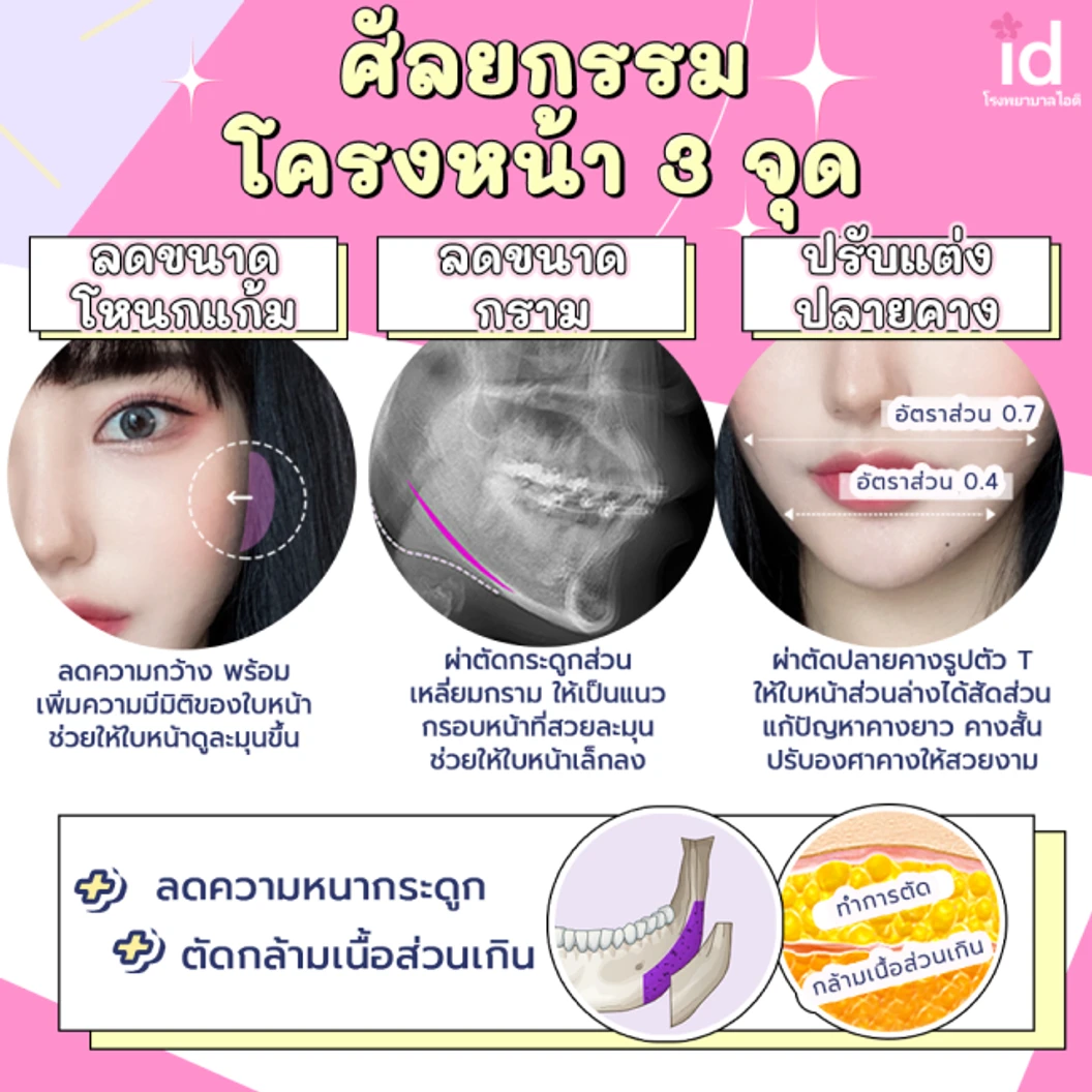 มัดจำผ่าตัดลดขนาดกราม สำหรับเคสทำครั้งแรก