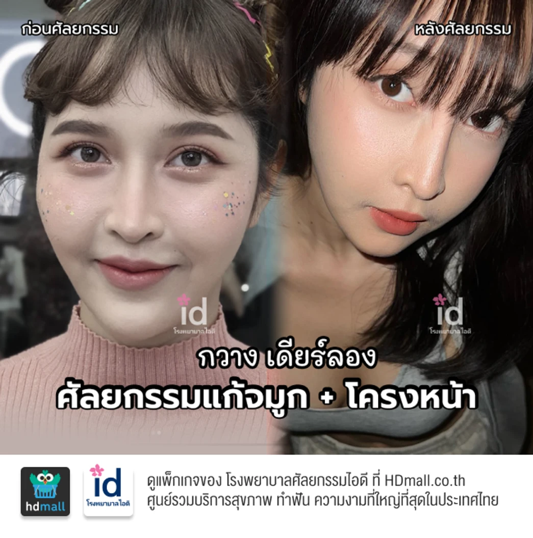 มัดจำผ่าตัดโครงหน้า 3 จุด ปรับโหนกแก้ม กราม และคางให้เข้ารูป สำหรับเคสทำครั้งแรก
