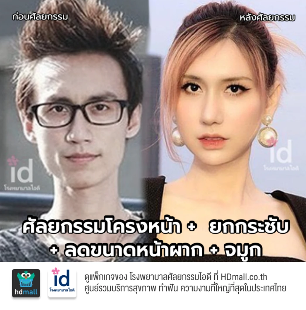 มัดจำผ่าตัดลดขนาดหน้าผาก สำหรับเคสทำครั้งแรก