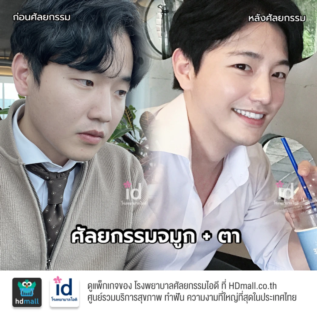 มัดจำทำตาสองชั้น สำหรับเคสทำครั้งแรก