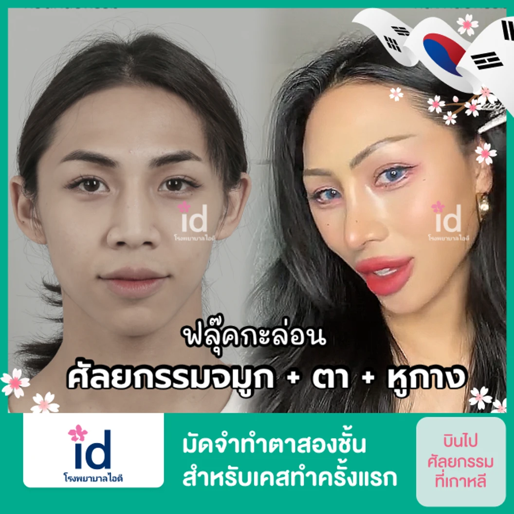 มัดจำทำตาสองชั้น สำหรับเคสทำครั้งแรก