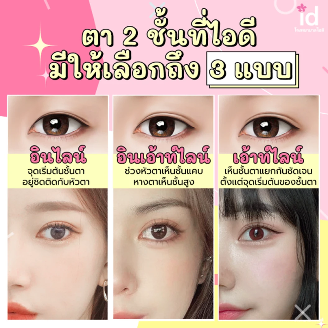 มัดจำศัลยกรรมตาสองชั้น สำหรับเคสแก้