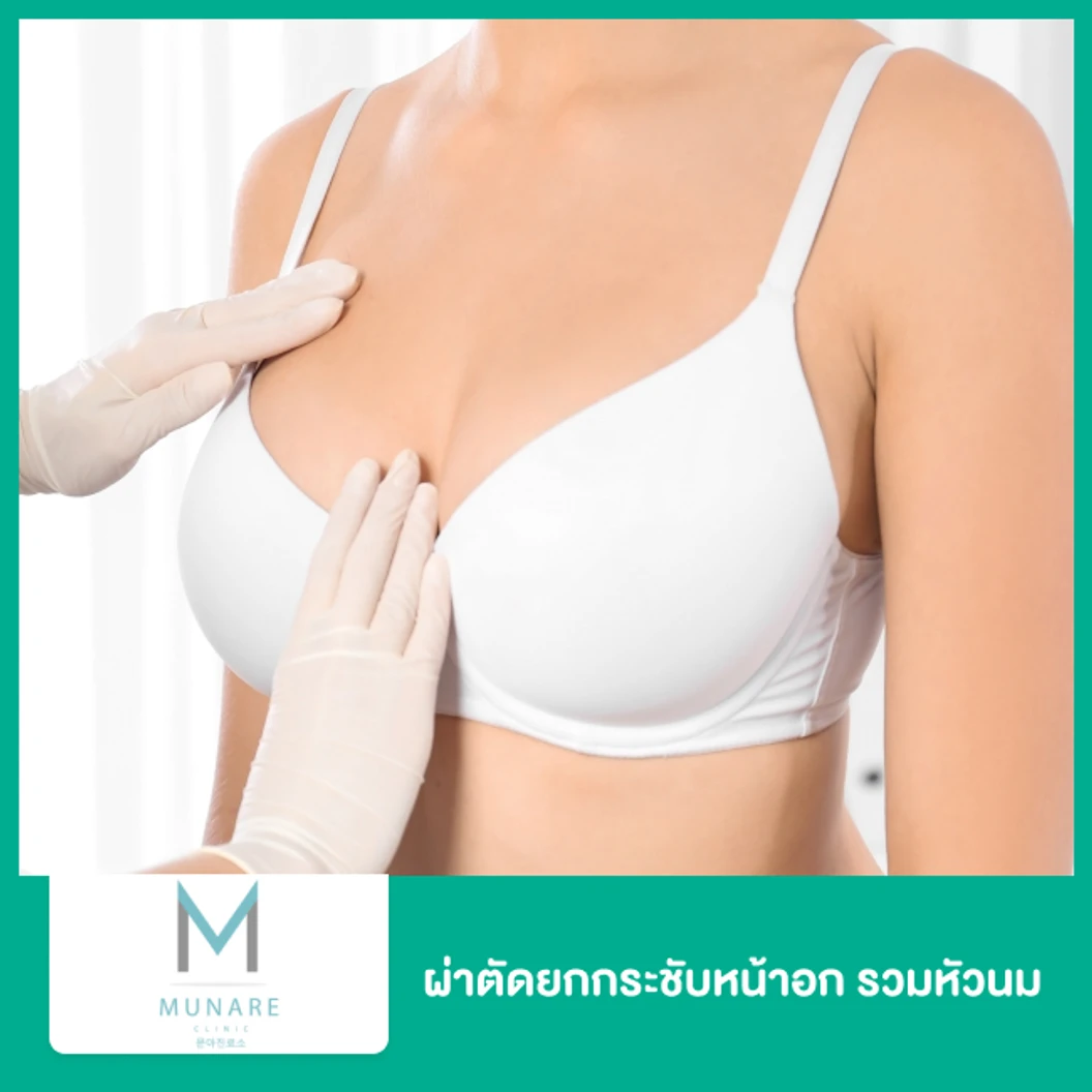 ผ่าตัดยกกระชับหน้าอก รวมหัวนม