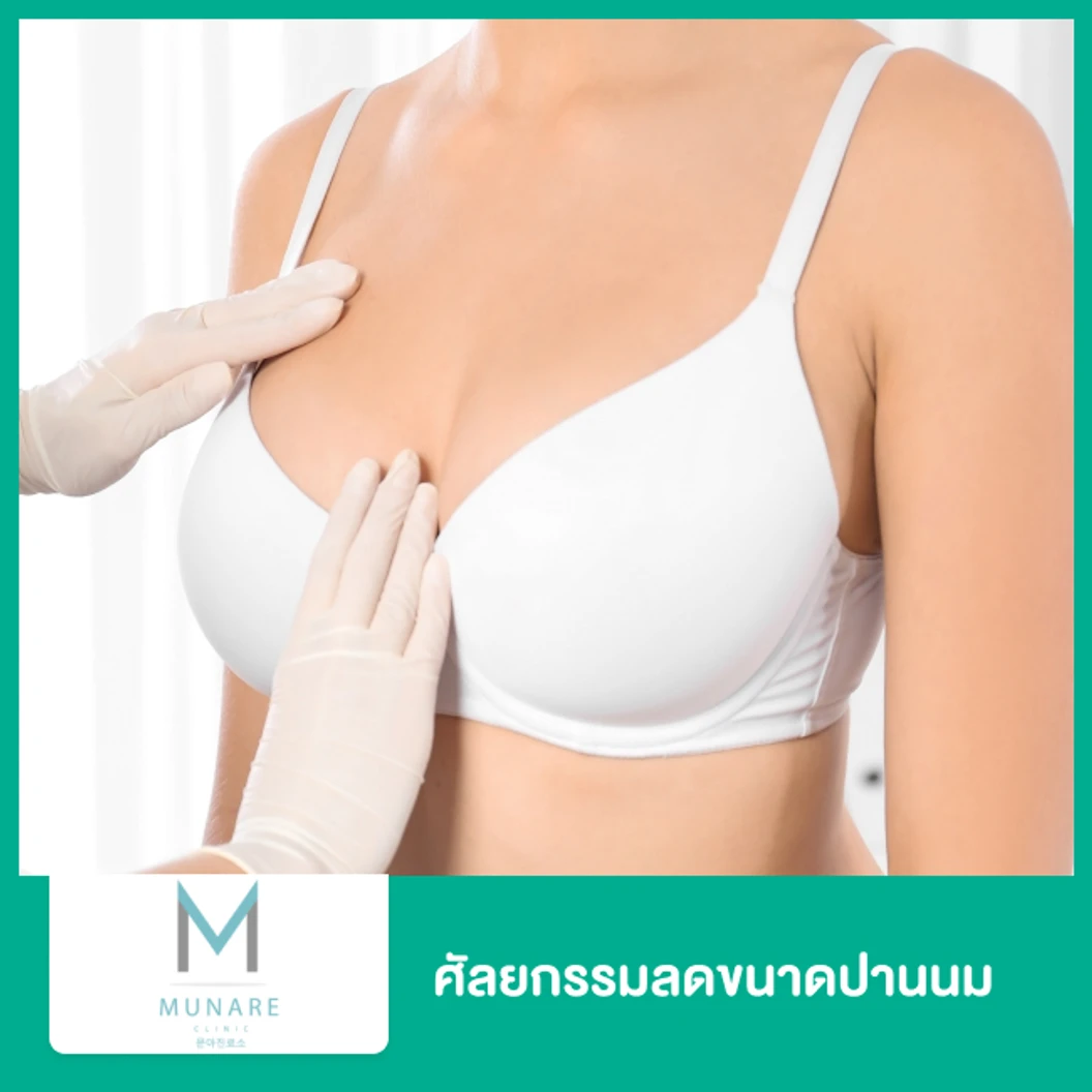 ศัลยกรรมลดขนาดปานนม