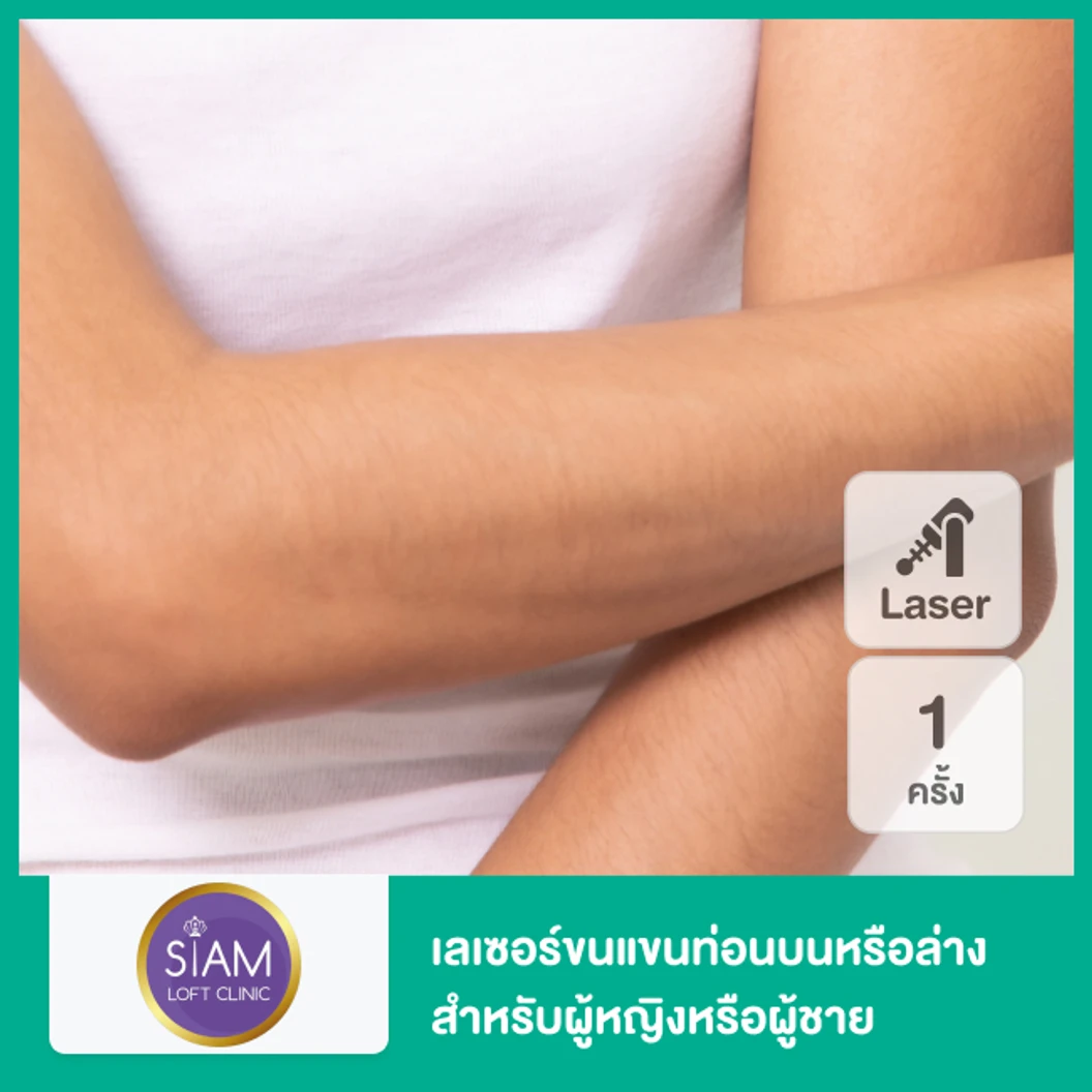 เลเซอร์ขนแขนท่อนบนหรือล่าง ด้วย Diode Laser 1 ครั้ง สำหรับผู้หญิงหรือผู้ชาย