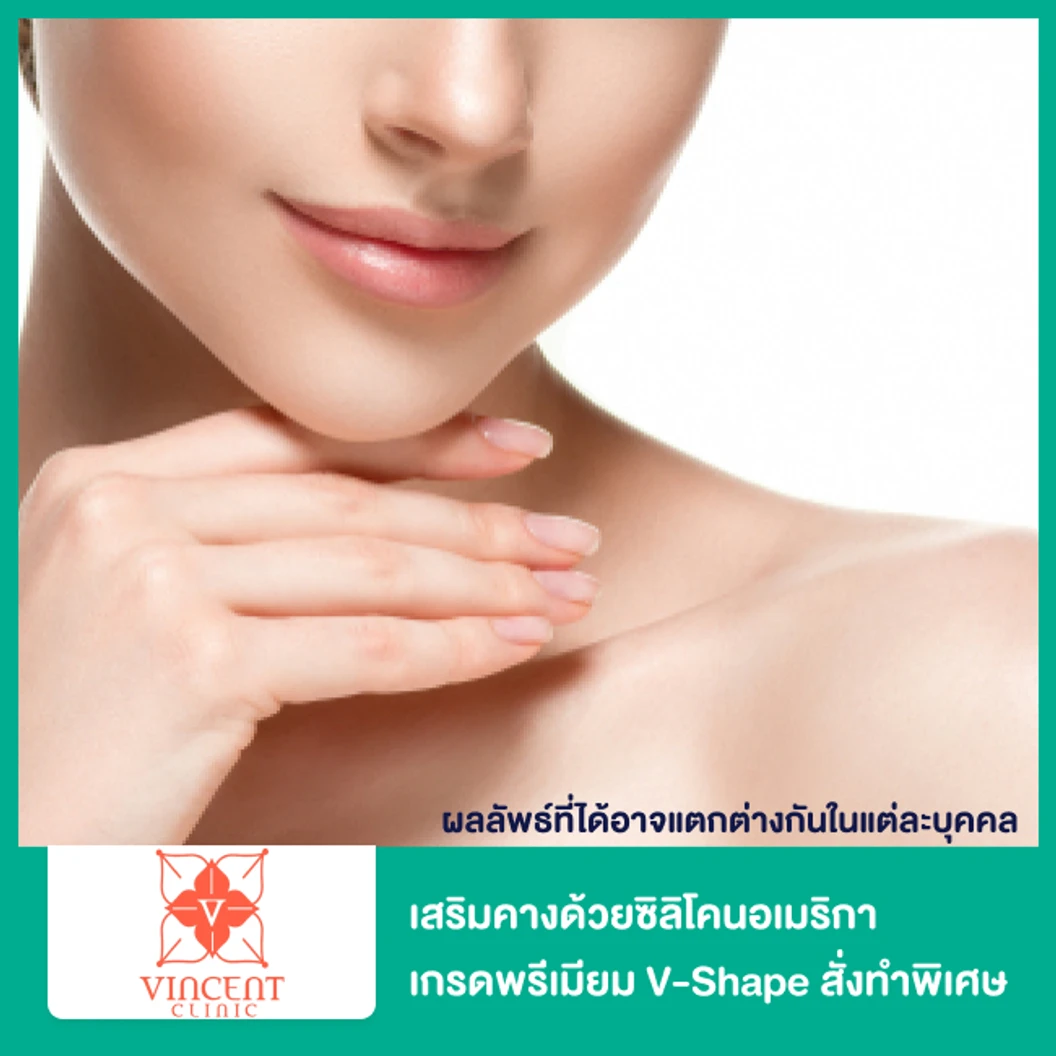 เสริมคางด้วยซิลิโคนอเมริกา เกรดพรีเมียม V-Shape แบบสั่งทำพิเศษ