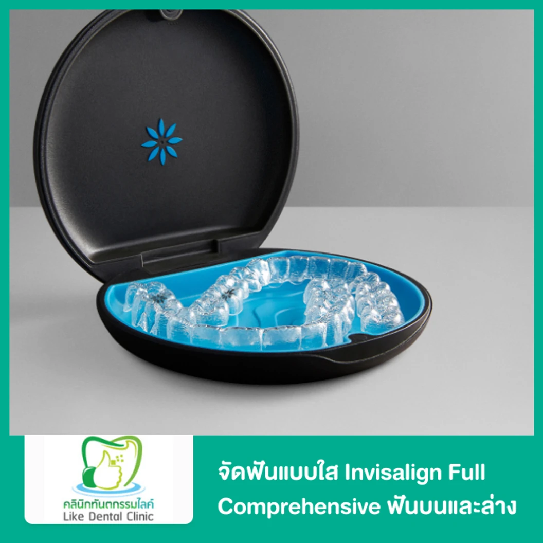 จัดฟันใส Invisalign Full Comprehensive ฟันบนและล่าง