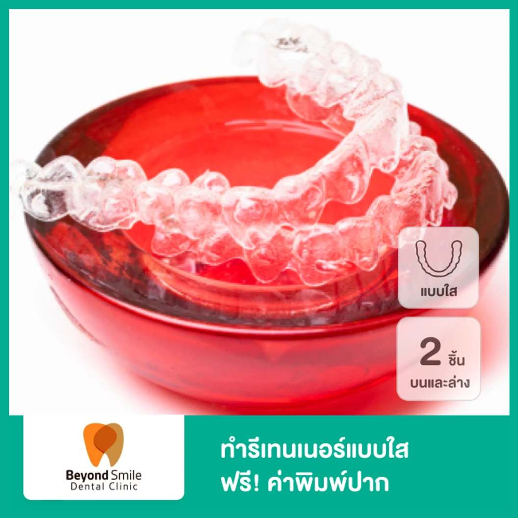 ทำรีเทนเนอร์แบบใส 2 ชิ้น ฟันบนและล่าง ฟรี! ค่าพิมพ์ปาก