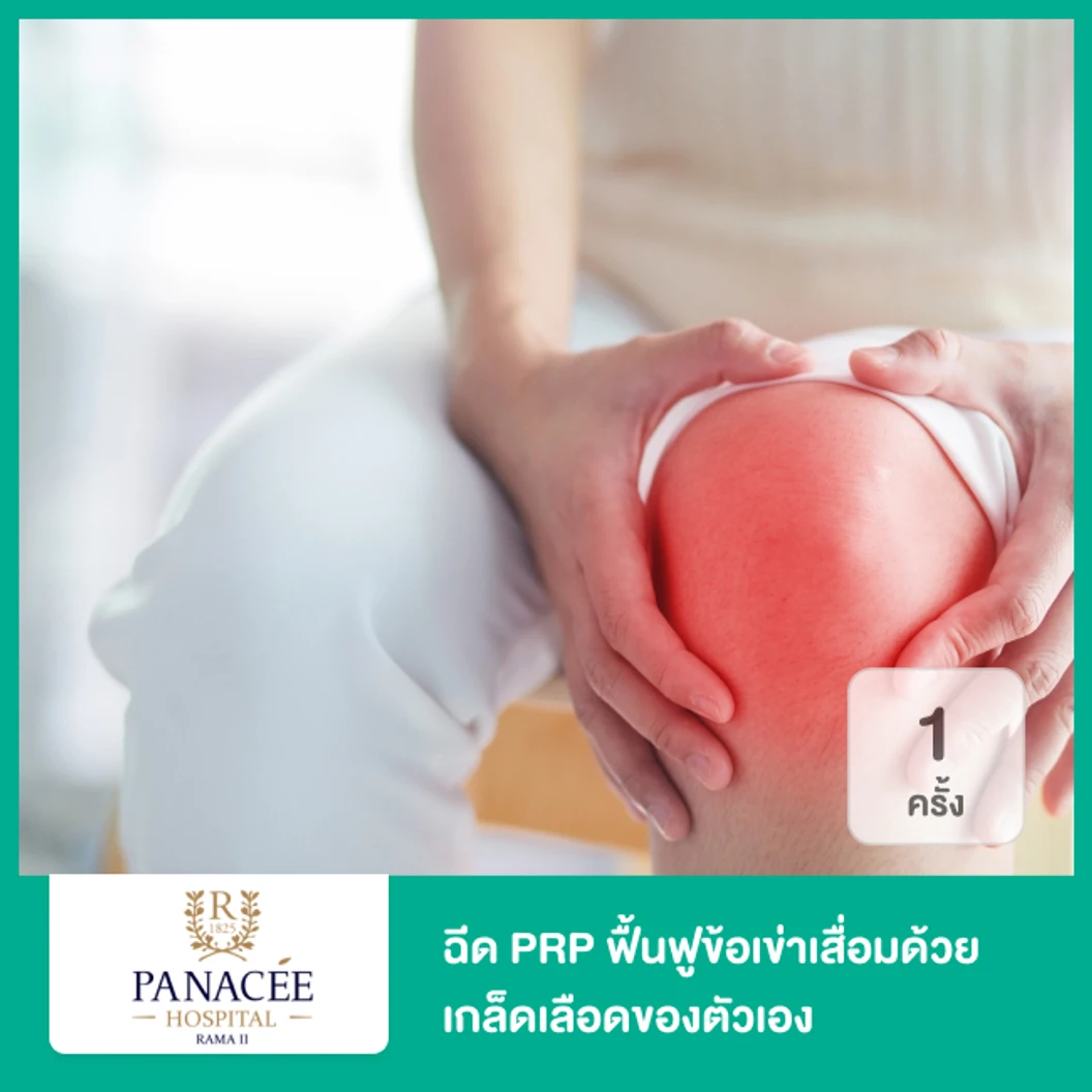 โปรแกรม PRP ฟื้นฟูข้อเข่าเสื่อมด้วยเกล็ดเลือดของตัวเอง 1 ครั้ง