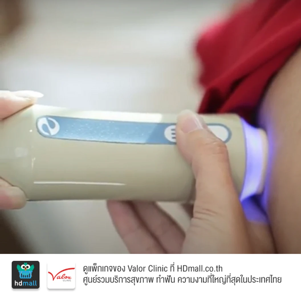 ตรวจภาวะพังผืดในตับและไขมันพอกตับ ด้วยเครื่องไฟโบรสแกน (FibroScan)