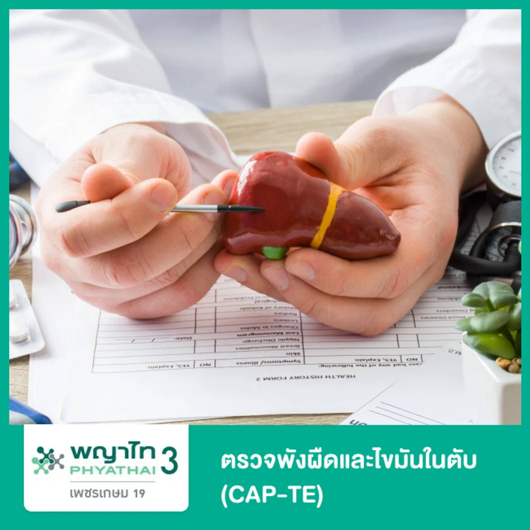 ตรวจไขมันพอกตับและพังผืดที่ตับ ด้วย Transient Elastography (TE) ที่ โรงพยาบาลพญาไท 3