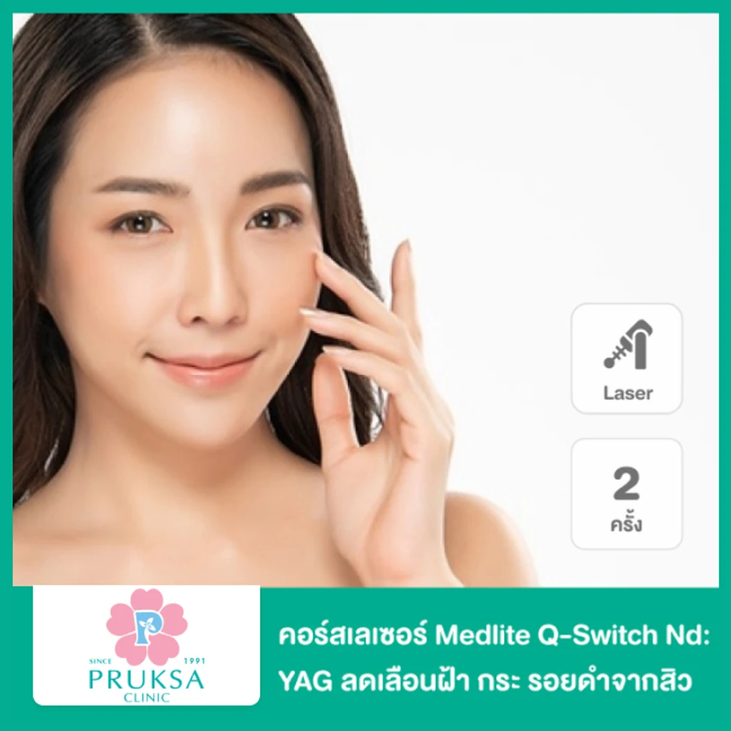เลเซอร์ Medlite Q-Switch Nd: YAG ลดเลือนฝ้า กระ รอยดำจากสิว (Laser Toning) ทั่วบริเวณใบหน้า 1 ครั้ง